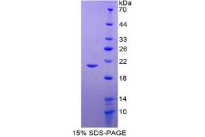 SDS-PAGE analysis of Glutathione Peroxidase 1 Protein. (Glutathione Peroxidase 1 Protein (GPX1))