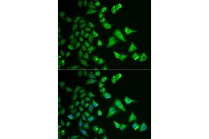 Immunofluorescence analysis of HeLa cells using DHRS2 antibody (ABIN5973846). (DHRS2 Antikörper)