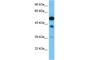 Host:  Mouse  Target Name:  FEN1  Sample Tissue:  Mouse Testis  Antibody Dilution:  1ug/ml (FEN1 Antikörper  (N-Term))