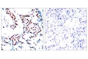 Immunohistochemistry (IHC) image for anti-Jun Proto-Oncogene (JUN) (Tyr170) antibody (ABIN1848122) (C-JUN Antikörper  (Tyr170))