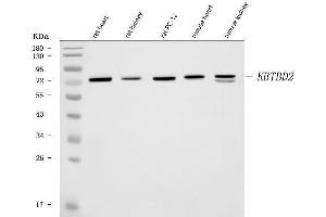 Western blot analysis of KBTBD2 using anti-KBTBD2 antibody (ABIN6719647). (KBTBD2 Antikörper)