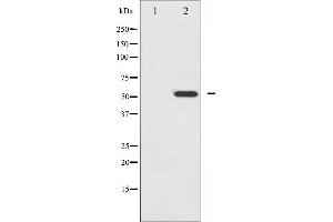 Western blot analysis of HNF4 alpha phosphorylation expression in EGF treated HuvEc whole cell lysates,The lane on the left is treated with the antigen-specific peptide. (HNF4A Antikörper  (pSer313))