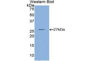 Western blot analysis of the recombinant protein. (CAMKII gamma Antikörper  (AA 75-281))