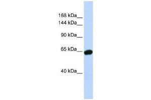 Western Blot showing ZNF91 antibody used at a concentration of 1-2 ug/ml to detect its target protein. (ZFP91 Antikörper  (N-Term))