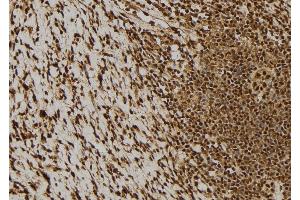 ABIN6276293 at 1/100 staining Human gastric tissue by IHC-P. (BCL2L1 Antikörper  (N-Term))