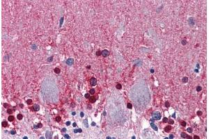 Human Brain, Cerebellum: Formalin-Fixed, Paraffin-Embedded (FFPE) (CBS Antikörper  (AA 1-101))