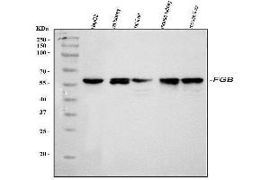 Western blot analysis of Fibrinogen beta chain/FGB using anti-Fibrinogen beta chain/FGB antibody (ABIN4886579). (Fibrinogen beta Chain Antikörper  (Middle Region))
