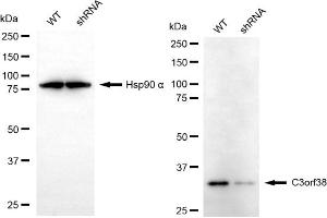 anti-Chromosome 3 Open Reading Frame 38 (C3orf38) antibody