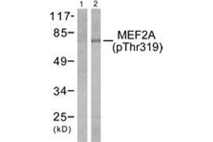 Western blot analysis of extracts from K562 cells treated with UV 15', using MEF2A (Phospho-Thr319) Antibody. (MEF2A Antikörper  (pThr319))