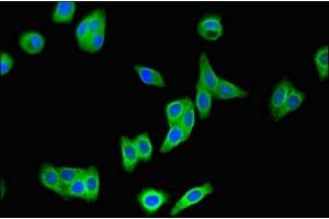 Immunofluorescence (IF) image for anti-Wingless-Type MMTV Integration Site Family, Member 7A (WNT7A) (AA 126-302) antibody (ABIN7166309)