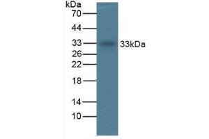 Figure. (TPSAB1 Antikörper  (AA 161-262))