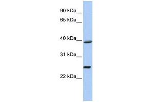 C12ORF42 antibody used at 1 ug/ml to detect target protein. (C12orf42 Antikörper  (N-Term))