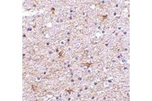 Immunohistochemistry of TMP21 in human brain tissue with this product at 2. (TMED10 Antikörper  (C-Term))