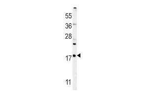 Western blot analysis in mouse liver tissue lysates (35ug/lane). (VAMP4 Antikörper  (AA 16-45))