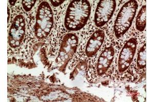 Immunohistochemistry (IHC) analysis of paraffin-embedded Human Colon, antibody was diluted at 1:100. (HLA-DQ1/DQ2 Antikörper  (Internal Region))