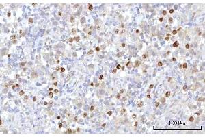 IHC analysis of RRP7A using anti-RRP7A antibody (ABIN7599044). (RRP7A Antikörper  (AA 1-181))