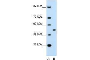 WB Suggested Anti-APBA1 Antibody Titration:  0. (APBA1 Antikörper  (N-Term))