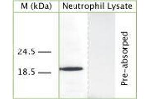 WB on human neutrophil lysate using Rabbit antibody to human Cathelicidin antimicrobial peptide (CAP-18, antibacterial protein LL-37, CAMP, CRAMP, FALL39): IgG (ABIN350184) at 50 µg/ml concentration. (Cathelicidin Antikörper)