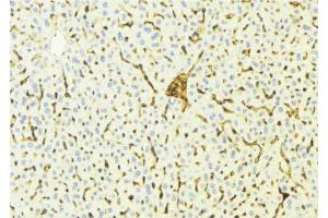 ABIN6275808 at 1/100 staining Mouse liver tissue by IHC-P. (CYP4V2 Antikörper  (Internal Region))