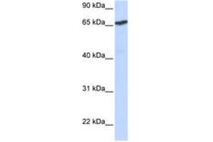 Image no. 1 for anti-L(3)mbt-Like 1 (L3MBTL1) (AA 144-193) antibody (ABIN6742622) (L3MBTL1 Antikörper  (AA 144-193))