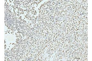 IHC analysis of p95 NBS1 using anti-p95 NBS1 antibody (ABIN7602793).