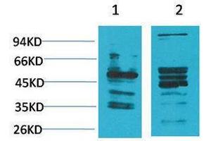 Western Blotting (WB) image for anti-Neuromedin B Receptor (NMBR) antibody (ABIN3179060) (NMBR Antikörper)