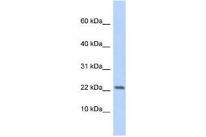 WB Suggested Anti-P2RX7 Antibody Titration: 0. (P2RX7 Antikörper  (Middle Region))