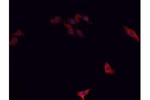 ABIN6266732 staining A-431 cells by IF/ICC. (PTTG1 Antikörper  (Internal Region))