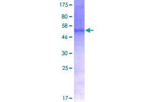 Image no. 1 for CD47 (CD47) (AA 1-323) protein (GST tag) (ABIN1348660) (CD47 Protein (CD47) (AA 1-323) (GST tag))