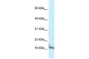 Western Blotting (WB) image for anti-Pterin-4 alpha-Carbinolamine Dehydratase/dimerization Cofactor of Hepatocyte Nuclear Factor 1 alpha (PCBD1) (C-Term) antibody (ABIN927379)