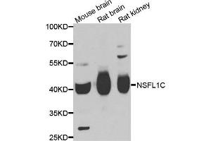 Western blot analysis of extracts of various cell lines, using NSFL1C antibody. (NSFL1C Antikörper)