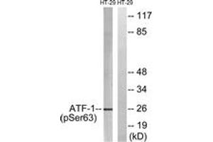 Western blot analysis of extracts from HT29 cells treated with Insulin 0. (AFT1 Antikörper  (pSer63))
