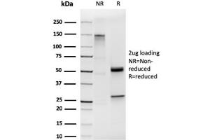 SDS-PAGE Analysis of Purified Cytokeratin 19 Rabbit Recombinant Monoclonal Antibody (KRT19/1959R). (Rekombinanter Cytokeratin 19 Antikörper)
