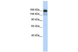WB Suggested Anti-XRN1 Antibody Titration:  0. (XRN1 Antikörper  (Middle Region))