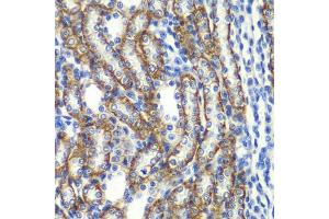 Immunohistochemistry of paraffin-embedded rat kidney using ZF antibody (ABIN6130814, ABIN6150426, ABIN6150427 and ABIN6223369) at dilution of 1:100 (40x lens). (ZFAND3 Antikörper  (AA 1-227))