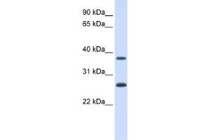 WB Suggested Anti-FAM156A Antibody Titration:  0. (FAM156A Antikörper  (N-Term))