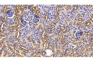 Immunohistochemistry (IHC) image for anti-Diazepam Binding Inhibitor (DBI) (AA 1-104) antibody (ABIN7435562)
