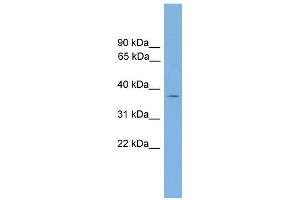 WB Suggested Anti-GALM Antibody Titration: 0.