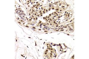 Immunohistochemistry of paraffin-embedded human breast using SNRPA Antibody. (SNRPA1 Antikörper)