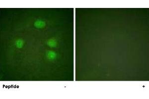 Immunofluorescence analysis of HeLa cells, using KCNJ3 polyclonal antibody . (KCNJ3 Antikörper  (Ser185))
