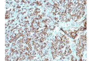 Formalin-fixed, paraffin-embedded human Tonsil stained with HLA- Pan Mouse Monoclonal Antibody (CR3/43).