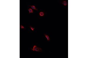 ABIN6276806 staining HepG2? (Decorin Antikörper  (Internal Region))