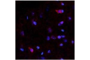 Netrin 4 antibody used at a concentration of 10 ug/ml to detect neurons and epithelial cells in rodent brain (red).