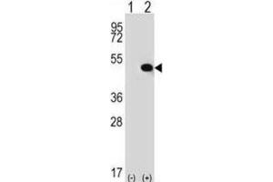 Western Blotting (WB) image for anti-Thyroid Hormone Receptor Interactor 13 (TRIP13) antibody (ABIN2996863) (TRIP13 Antikörper)