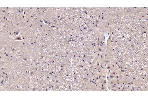 Immunohistochemistry (IHC) image for anti-Brain-Derived Neurotrophic Factor (BDNF) (AA 20-252) antibody (ABIN7430375)