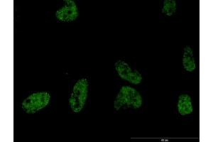 Immunofluorescence of monoclonal antibody to PLCB2 on HeLa cell.