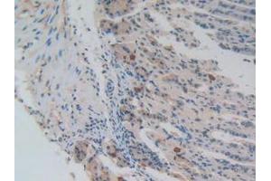 IHC-P analysis of Mouse Stomach Tissue, with DAB staining. (NUP85 Antikörper  (AA 418-653))
