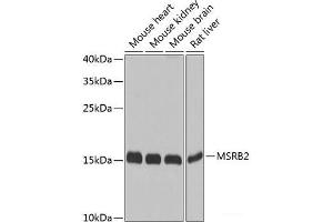 Western blot analysis of extracts of various cell lines using MSRB2 Polyclonal Antibody at dilution of 1:1000. (MSRB2 Antikörper)