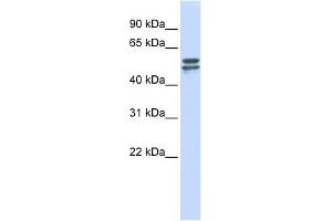 G6PD antibody used at 1 ug/ml to detect target protein. (Glucose-6-Phosphate Dehydrogenase Antikörper  (Middle Region))