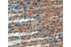 Figure. (GREM1 Antikörper  (AA 26-184))